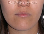 Apgujeong Dream Plastic Surgery Clinic,Reviews,Images, Promotions — Korea cost, reviews & before-after | MISOODA