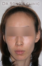 Apgujeong Dream Plastic Surgery Clinic,Reviews,Images, Promotions — Korea cost, reviews & before-after | MISOODA
