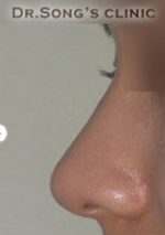 Apgujeong Dream Plastic Surgery Clinic,Reviews,Images, Promotions — Korea cost, reviews & before-after | MISOODA
