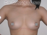 Apgujeong Dream Plastic Surgery Clinic,Reviews,Images, Promotions — Korea cost, reviews & before-after | MISOODA