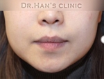 Apgujeong Dream Plastic Surgery Clinic,Reviews,Images, Promotions — Korea cost, reviews & before-after | MISOODA