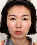 facial contouring