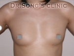 Apgujeong Dream Plastic Surgery Clinic,Reviews,Images, Promotions — Korea cost, reviews & before-after | MISOODA