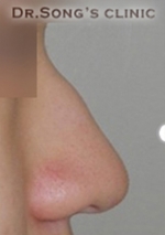 Apgujeong Dream Plastic Surgery Clinic,Reviews,Images, Promotions — Korea cost, reviews & before-after | MISOODA