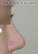 Apgujeong Dream Plastic Surgery Clinic,Reviews,Images, Promotions — Korea cost, reviews & before-after | MISOODA