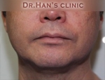 Apgujeong Dream Plastic Surgery Clinic,Reviews,Images, Promotions — Korea cost, reviews & before-after | MISOODA