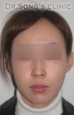 Apgujeong Dream Plastic Surgery Clinic,Reviews,Images, Promotions — Korea cost, reviews & before-after | MISOODA