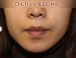 Apgujeong Dream Plastic Surgery Clinic,Reviews,Images, Promotions — Korea cost, reviews & before-after | MISOODA