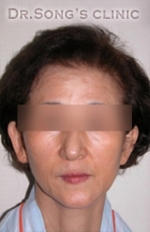 Apgujeong Dream Plastic Surgery Clinic,Reviews,Images, Promotions — Korea cost, reviews & before-after | MISOODA