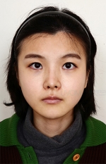 facial contouring