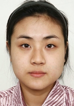 facial contouring