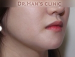 Apgujeong Dream Plastic Surgery Clinic,Reviews,Images, Promotions — Korea cost, reviews & before-after | MISOODA