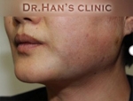 Apgujeong Dream Plastic Surgery Clinic,Reviews,Images, Promotions — Korea cost, reviews & before-after | MISOODA