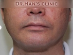Apgujeong Dream Plastic Surgery Clinic,Reviews,Images, Promotions — Korea cost, reviews & before-after | MISOODA