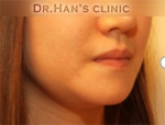 Apgujeong Dream Plastic Surgery Clinic,Reviews,Images, Promotions — Korea cost, reviews & before-after | MISOODA