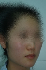 SEIN Aesthetic Plastic Surgery Clinic,Reviews,Images, Promotions — Korea cost, reviews & before-after | MISOODA