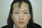 SEIN Aesthetic Plastic Surgery Clinic,Reviews,Images, Promotions — Korea cost, reviews & before-after | MISOODA