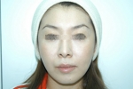 SEIN Aesthetic Plastic Surgery Clinic,Reviews,Images, Promotions — Korea cost, reviews & before-after | MISOODA