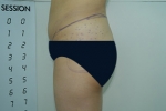 SEIN Aesthetic Plastic Surgery Clinic,Reviews,Images, Promotions — Korea cost, reviews & before-after | MISOODA