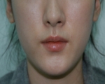 SEIN Aesthetic Plastic Surgery Clinic,Reviews,Images, Promotions — Korea cost, reviews & before-after | MISOODA