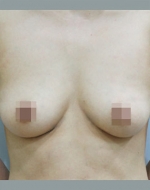 YUJIN Plastic Surgery & Aesthetic,Reviews,Images, Promotions, MISOODA — Korea cost, reviews & before-after | MISOODA
