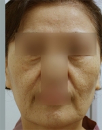 YUJIN Plastic Surgery & Aesthetic,Reviews,Images, Promotions, MISOODA — Korea cost, reviews & before-after | MISOODA