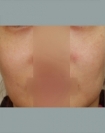 YUJIN Plastic Surgery & Aesthetic,Reviews,Images, Promotions, MISOODA — Korea cost, reviews & before-after | MISOODA