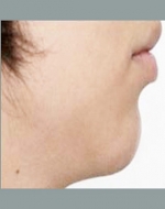 YUJIN Plastic Surgery & Aesthetic,Reviews,Images, Promotions, MISOODA — Korea cost, reviews & before-after | MISOODA