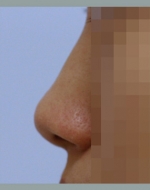 YUJIN Plastic Surgery & Aesthetic,Reviews,Images, Promotions, MISOODA — Korea cost, reviews & before-after | MISOODA