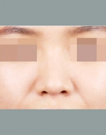 YUJIN Plastic Surgery & Aesthetic,Reviews,Images, Promotions, MISOODA — Korea cost, reviews & before-after | MISOODA