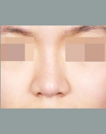 YUJIN Plastic Surgery & Aesthetic,Reviews,Images, Promotions, MISOODA — Korea cost, reviews & before-after | MISOODA