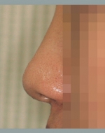YUJIN Plastic Surgery & Aesthetic,Reviews,Images, Promotions, MISOODA — Korea cost, reviews & before-after | MISOODA