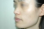 SEIN Aesthetic Plastic Surgery Clinic,Reviews,Images, Promotions — Korea cost, reviews & before-after | MISOODA
