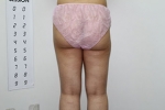 SEIN Aesthetic Plastic Surgery Clinic,Reviews,Images, Promotions — Korea cost, reviews & before-after | MISOODA