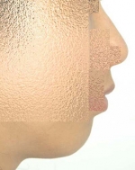 SEIN Aesthetic Plastic Surgery Clinic,Reviews,Images, Promotions — Korea cost, reviews & before-after | MISOODA