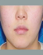 YUJIN Plastic Surgery & Aesthetic,Reviews,Images, Promotions, MISOODA — Korea cost, reviews & before-after | MISOODA