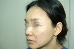 SEIN Aesthetic Plastic Surgery Clinic,Reviews,Images, Promotions — Korea cost, reviews & before-after | MISOODA