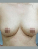 YUJIN Plastic Surgery & Aesthetic,Reviews,Images, Promotions, MISOODA — Korea cost, reviews & before-after | MISOODA