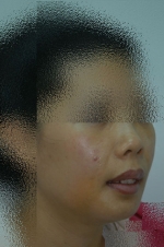 SEIN Aesthetic Plastic Surgery Clinic,Reviews,Images, Promotions — Korea cost, reviews & before-after | MISOODA