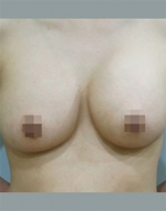 YUJIN Plastic Surgery & Aesthetic,Reviews,Images, Promotions, MISOODA — Korea cost, reviews & before-after | MISOODA