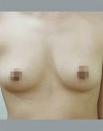 YUJIN Plastic Surgery & Aesthetic,Reviews,Images, Promotions, MISOODA — Korea cost, reviews & before-after | MISOODA