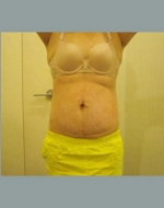 YUJIN Plastic Surgery & Aesthetic,Reviews,Images, Promotions, MISOODA — Korea cost, reviews & before-after | MISOODA