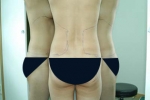 SEIN Aesthetic Plastic Surgery Clinic,Reviews,Images, Promotions — Korea cost, reviews & before-after | MISOODA