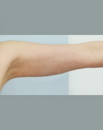 YUJIN Plastic Surgery & Aesthetic,Reviews,Images, Promotions, MISOODA — Korea cost, reviews & before-after | MISOODA