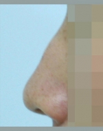 YUJIN Plastic Surgery & Aesthetic,Reviews,Images, Promotions, MISOODA — Korea cost, reviews & before-after | MISOODA