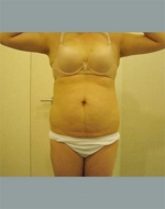 YUJIN Plastic Surgery & Aesthetic,Reviews,Images, Promotions, MISOODA — Korea cost, reviews & before-after | MISOODA