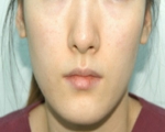SEIN Aesthetic Plastic Surgery Clinic,Reviews,Images, Promotions — Korea cost, reviews & before-after | MISOODA
