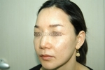 SEIN Aesthetic Plastic Surgery Clinic,Reviews,Images, Promotions — Korea cost, reviews & before-after | MISOODA