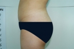 SEIN Aesthetic Plastic Surgery Clinic,Reviews,Images, Promotions — Korea cost, reviews & before-after | MISOODA