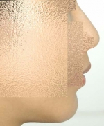 SEIN Aesthetic Plastic Surgery Clinic,Reviews,Images, Promotions — Korea cost, reviews & before-after | MISOODA